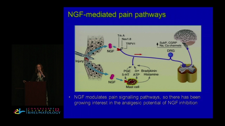 Osteoarthritis Update